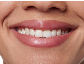 ¿Me pongo fundas o implantes?