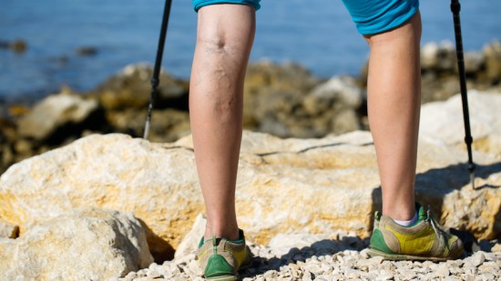 iStock-538990211