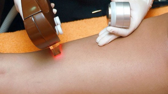 hair-removal-4188610_1280