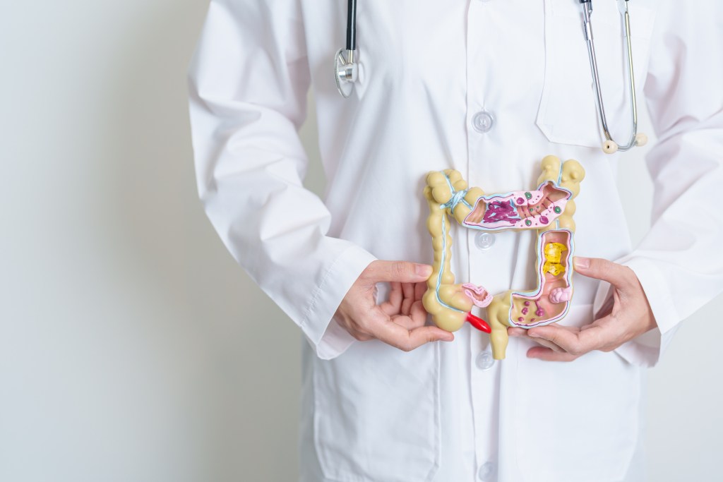 ¿El cáncer de colon está asociado a la edad? Un experto responde
