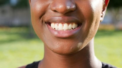 Cómo prevenir los dientes amarillos según un odontólogo